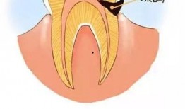 漫画蛀,揭示社会阴暗面的漫画故事